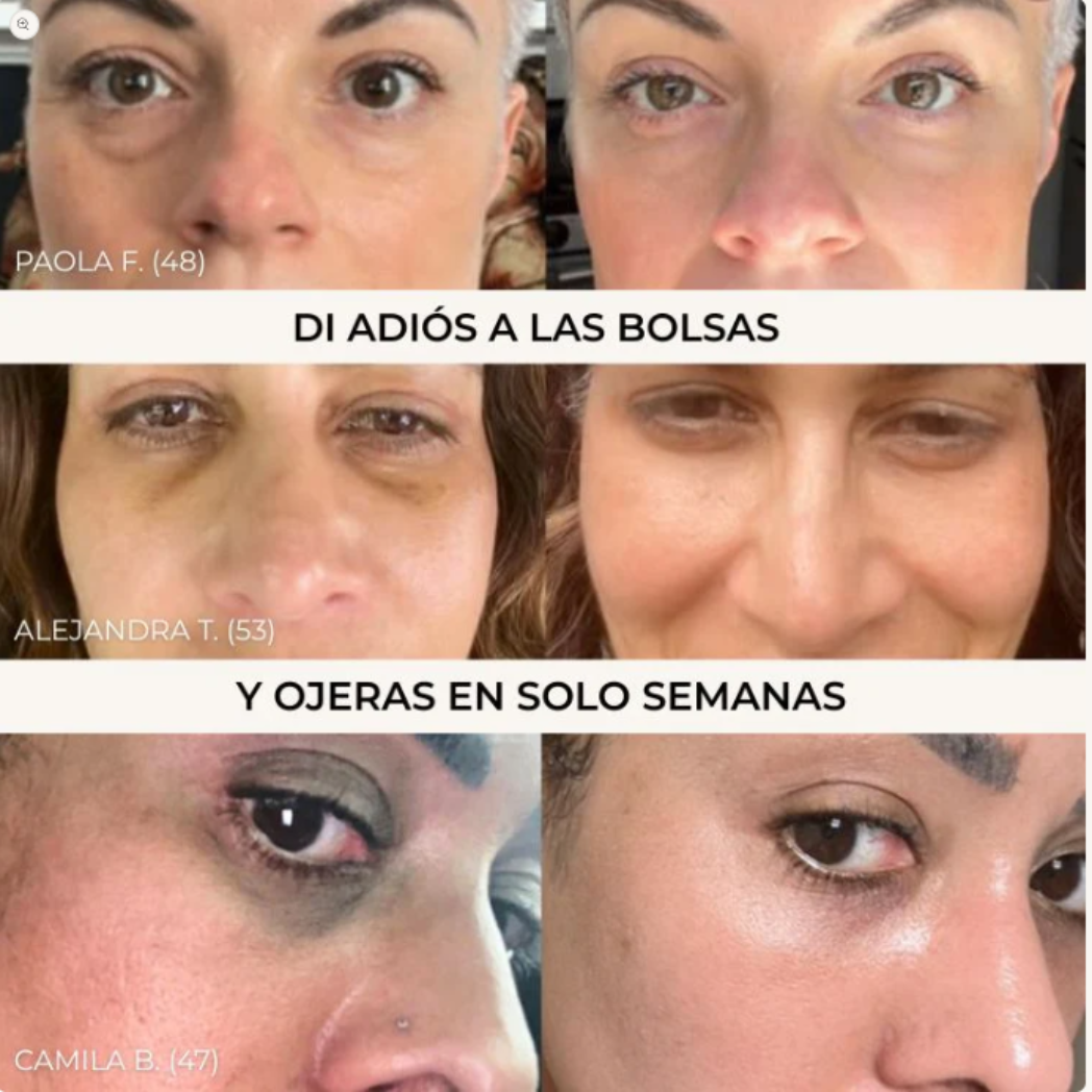 Parches de Oro 24K – Luxury Eye Rejuvenation & Anti-Dark Circles (30+30Pcs)