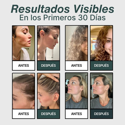 Cabezal De Ducha Con Filtro Antical y Anticloro Para Cuidar Tu Piel y Tu Cabello.